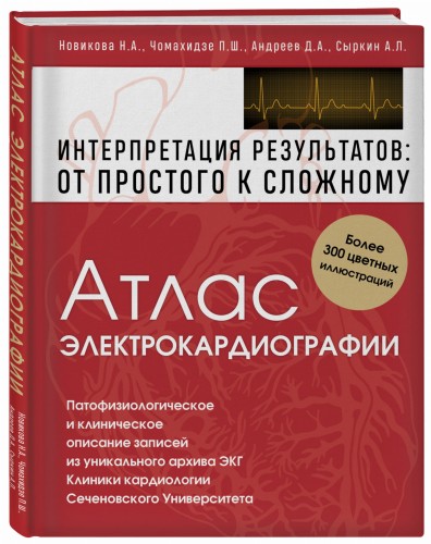 Атлас электрокардиографии. Интерпретация результатов: от простого к сложному