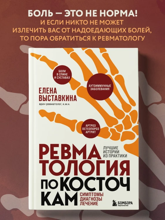 Ревматология по косточкам. Симптомы, диагнозы, лечение