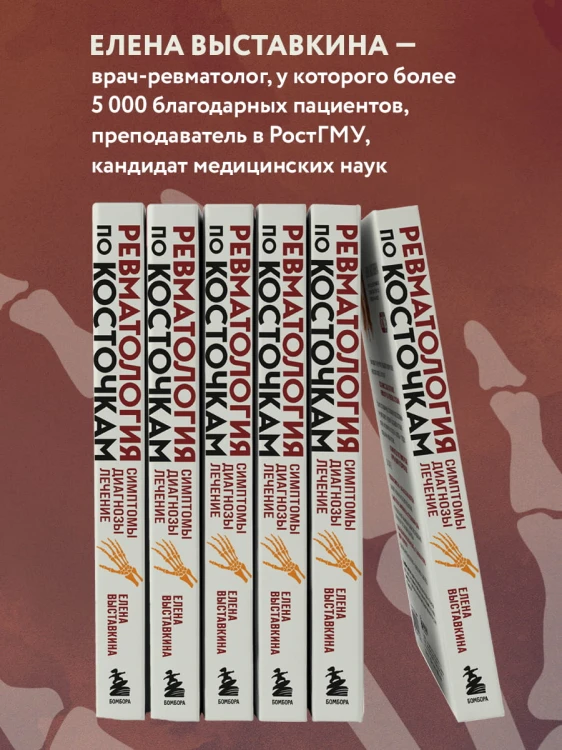 Ревматология по косточкам. Симптомы, диагнозы, лечение