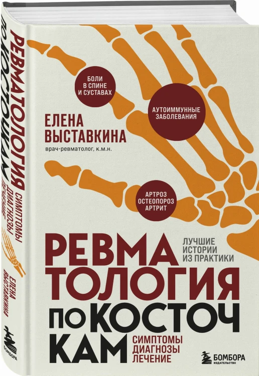 Ревматология по косточкам. Симптомы, диагнозы, лечение