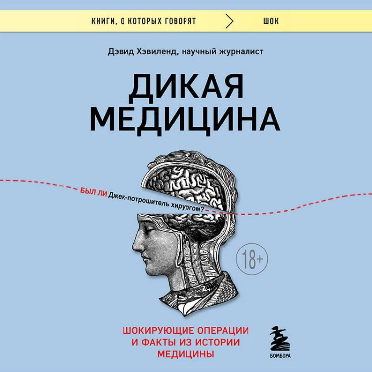 Дикая медицина. Шокирующие операции и факты из истории медицины