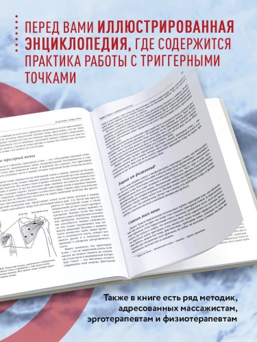 Синдром «замороженного» плеча. Терапия триггерных точек для преодоления боли и восстановления диапазона движений
