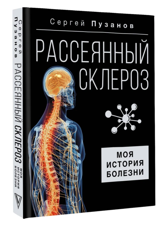 Рассеянный склероз. Моя история болезни