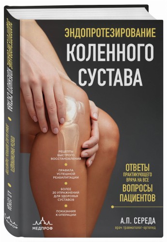 Эндопротезирование коленного сустава: ответы практикующего врача на все вопросы пациентов