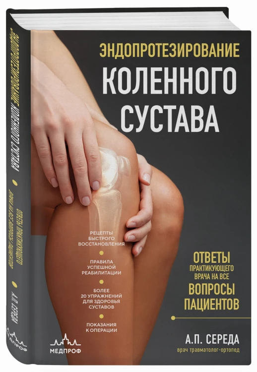 Эндопротезирование коленного сустава: ответы практикующего врача на все вопросы пациентов