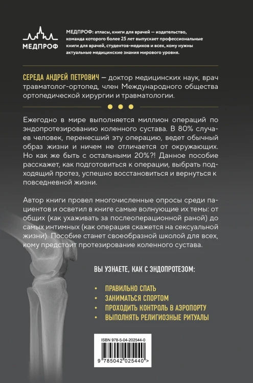 Эндопротезирование коленного сустава: ответы практикующего врача на все вопросы пациентов