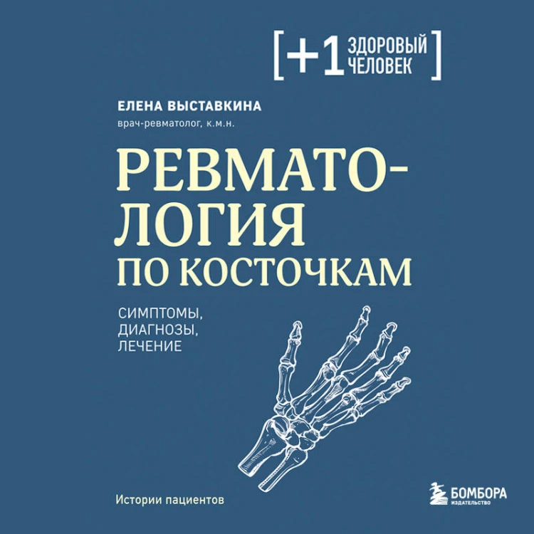 Ревматология по косточкам. Симптомы, диагнозы, лечение