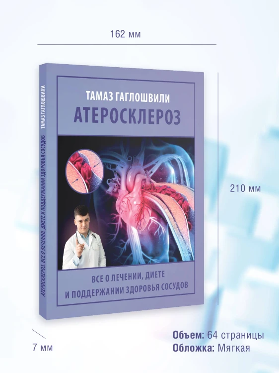 Атеросклероз. Все о лечении, диете и поддержании здоровья сосудов