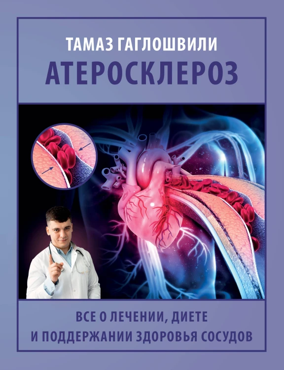 Атеросклероз. Все о лечении, диете и поддержании здоровья сосудов